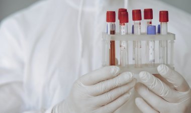 Korona stanje u Istri: skoro 40 novozaraženih, bez preminulih