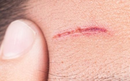 Metal koji zacjeljuje poput živog tkiva