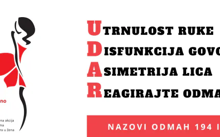 U četvrtak predavanje o moždanom udaru u organizaciji Zdravog Novigrada